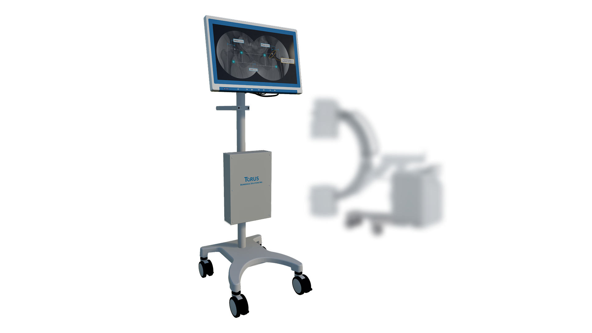 Torus Biomedical Solutions screenshot 1